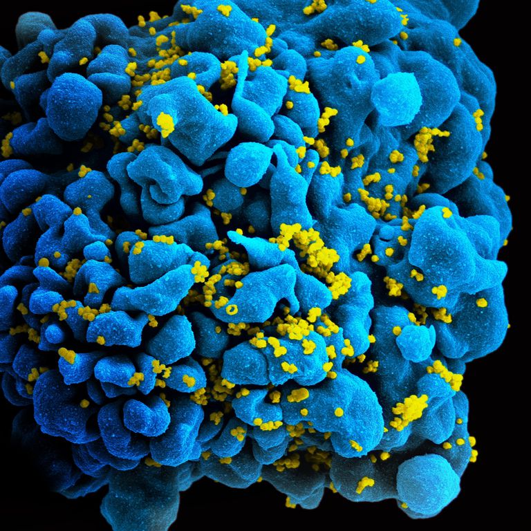 New Advances in HIV Treatment